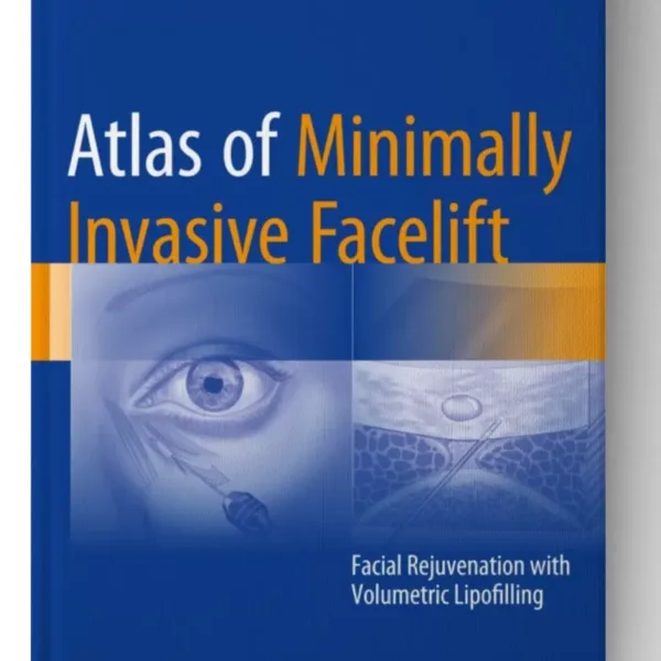 Atlas of Minimally Invasive Facelift: Facial Rejuvenation with Volumetric Lipofilling
