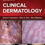 Fitzpatrick's Color Atlas and Synopsis of Clinical Dermatology