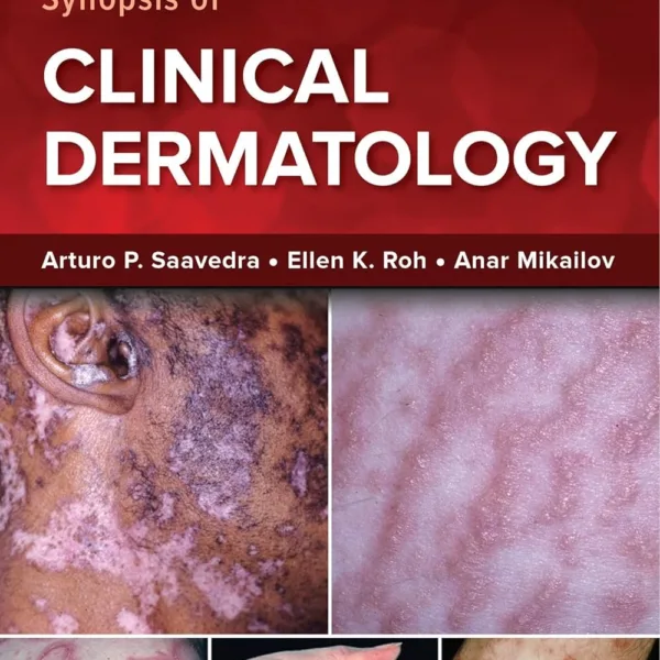 Fitzpatrick's Color Atlas and Synopsis of Clinical Dermatology