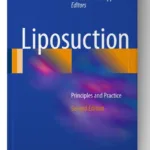 Liposuction: Principles and Practice