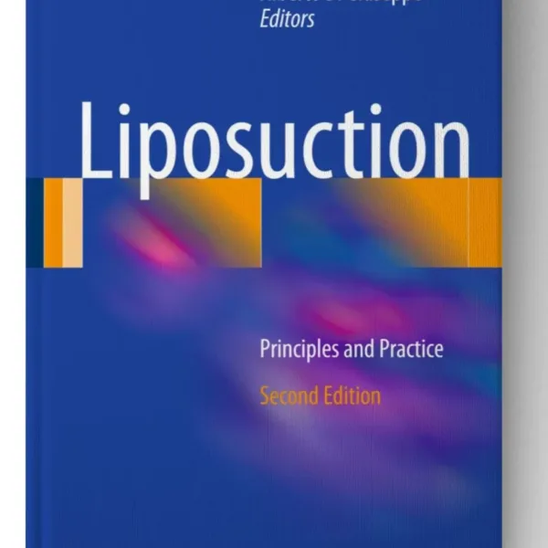 Liposuction: Principles and Practice