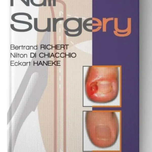 Nail Surgery (Series in Dermatological Treatment)