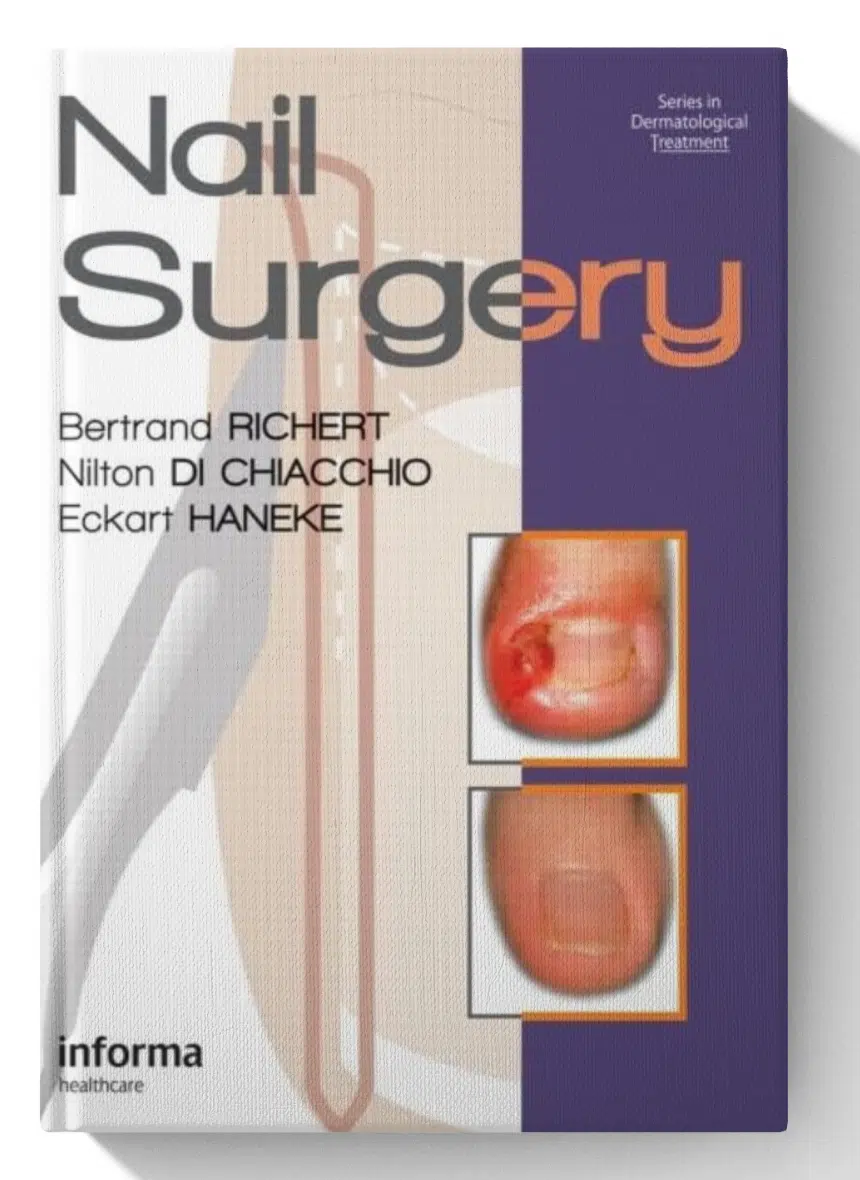Nail-Surgery-Series-in-Dermatological-Treatment.webp Nail Surgery (Series in Dermatological Treatment) - Image 1